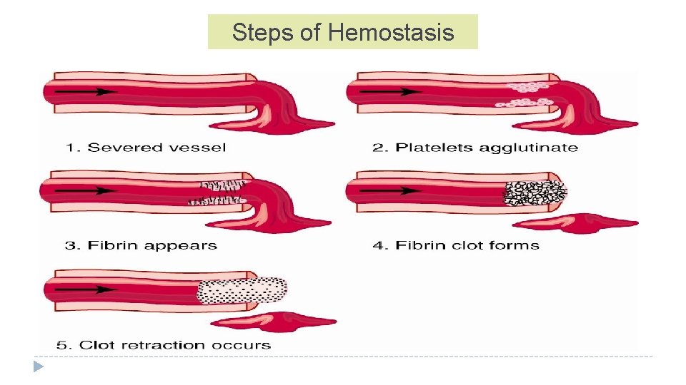 Steps of Hemostasis 