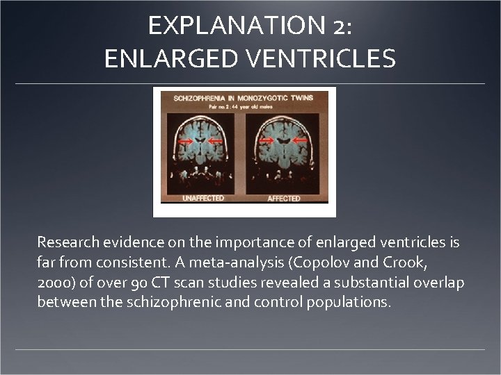 EXPLANATION 2: ENLARGED VENTRICLES Research evidence on the importance of enlarged ventricles is far