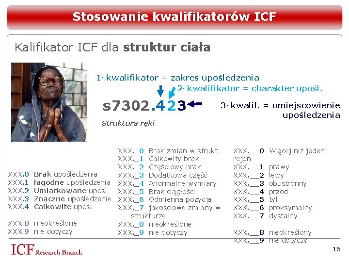 Stosowanie kwalifikatorów ICF Kalifikator ICF dla struktur ciała 1. kwalifikator = zakres upośledzenia 2.