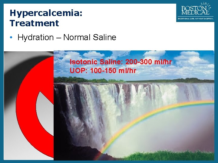 Hypercalcemia: Treatment 29 • Hydration – Normal Saline Isotonic Saline: 200 -300 ml/hr UOP: