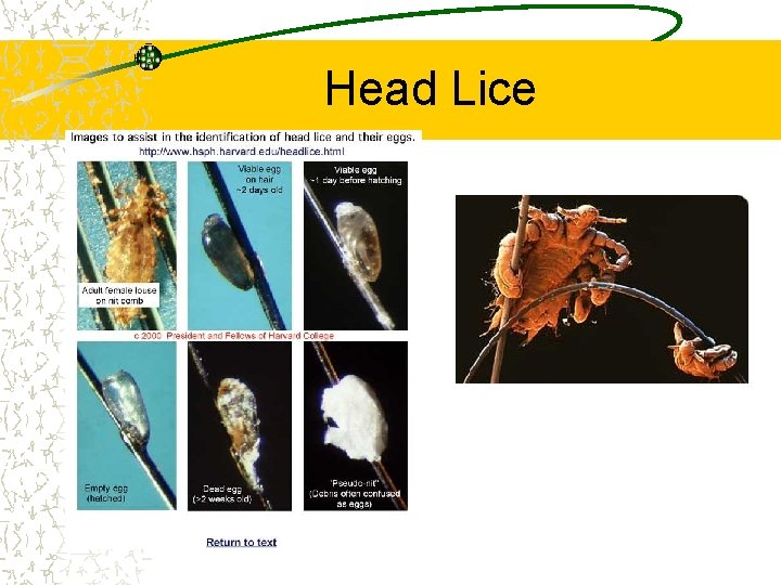 Head Lice 