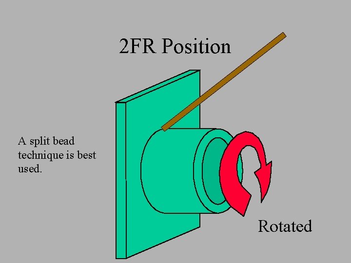 2 FR Position A split bead technique is best used. Rotated 2 FR Position A split bead technique is best used. Rotated