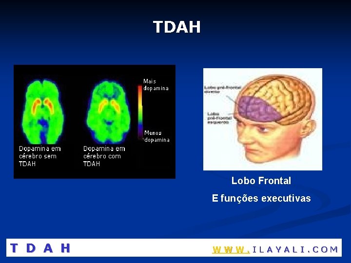 TDAH Lobo Frontal E funções executivas T D A H WWW. ILAYALI. COM 