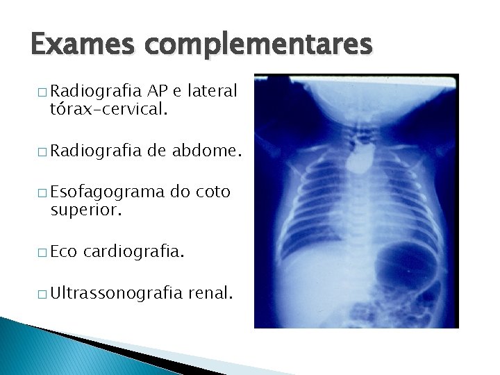 Exames complementares � Radiografia AP e lateral tórax-cervical. � Radiografia de abdome. � Esofagograma