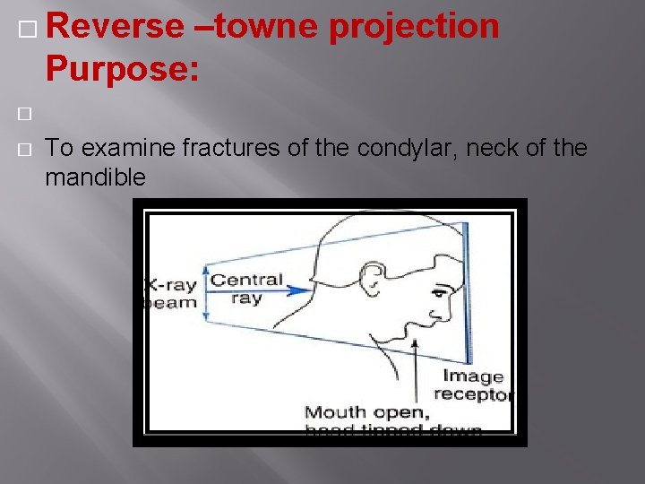 � Reverse –towne projection Purpose: � � To examine fractures of the condylar, neck