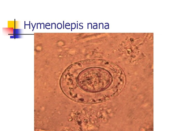 Hymenolepis nana 