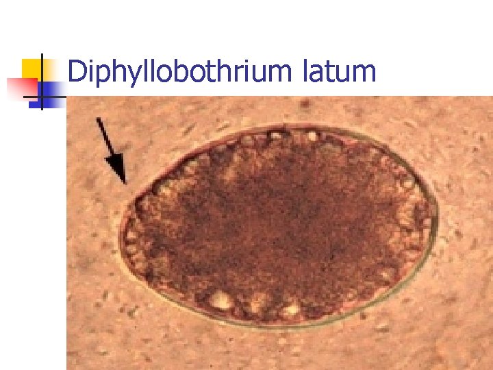 Diphyllobothrium latum 