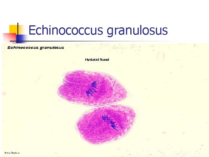 Echinococcus granulosus 