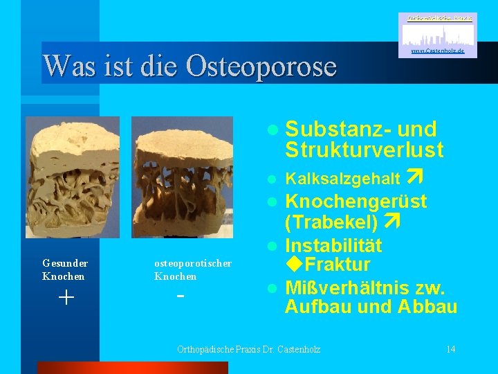 Orthopädische Praxis Was ist die Osteoporose www. Castenholz. de l Substanzl und Strukturverlust Kalksalzgehalt