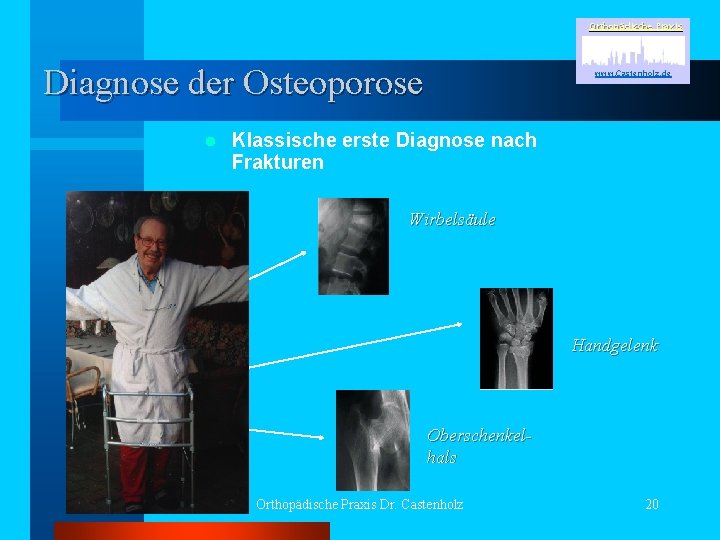 Orthopädische Praxis Diagnose der Osteoporose l www. Castenholz. de Klassische erste Diagnose nach Frakturen