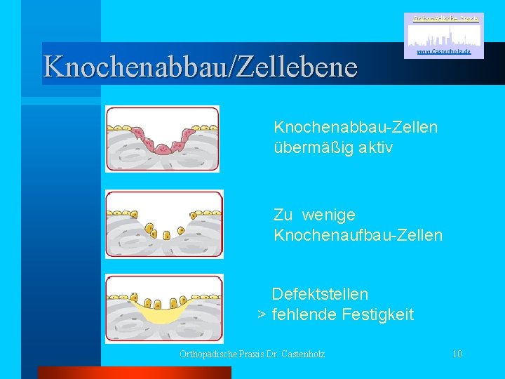 Orthopädische Praxis Knochenabbau/Zellebene www. Castenholz. de Knochenabbau-Zellen übermäßig aktiv Zu wenige Knochenaufbau-Zellen Defektstellen >