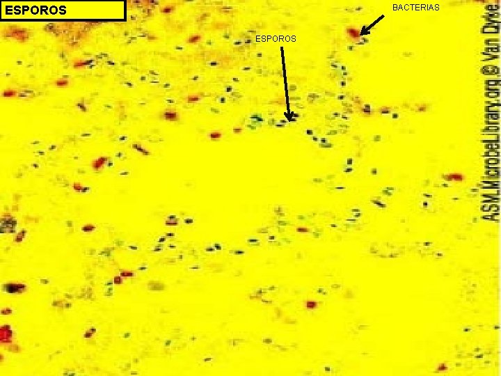 BACTERIAS ESPOROS BACTERIAS ESPOROS