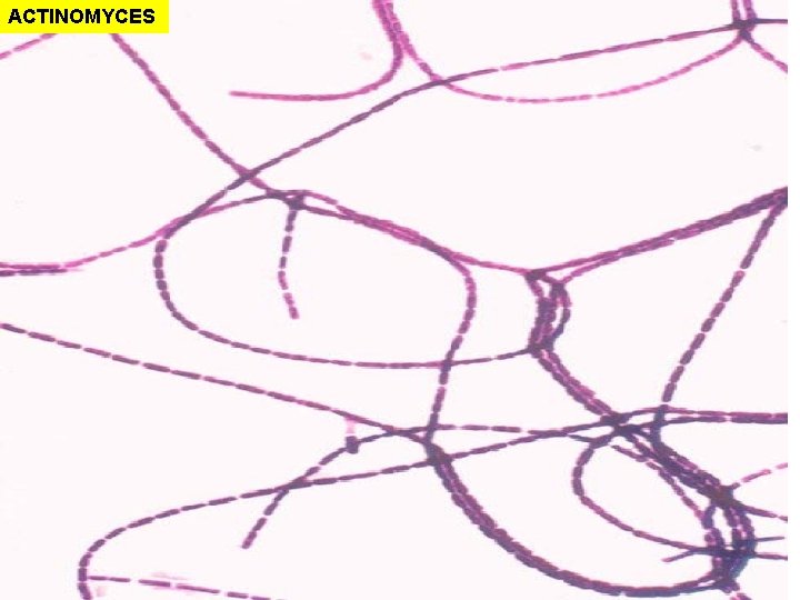 ACTINOMYCES ACTINOMYCES