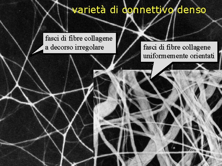 varietà di connettivo denso fasci di fibre collagene a decorso irregolare fasci di fibre