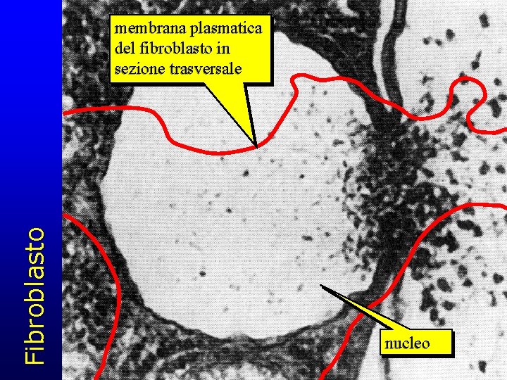 Fibroblasto membrana plasmatica del fibroblasto in sezione trasversale nucleo 