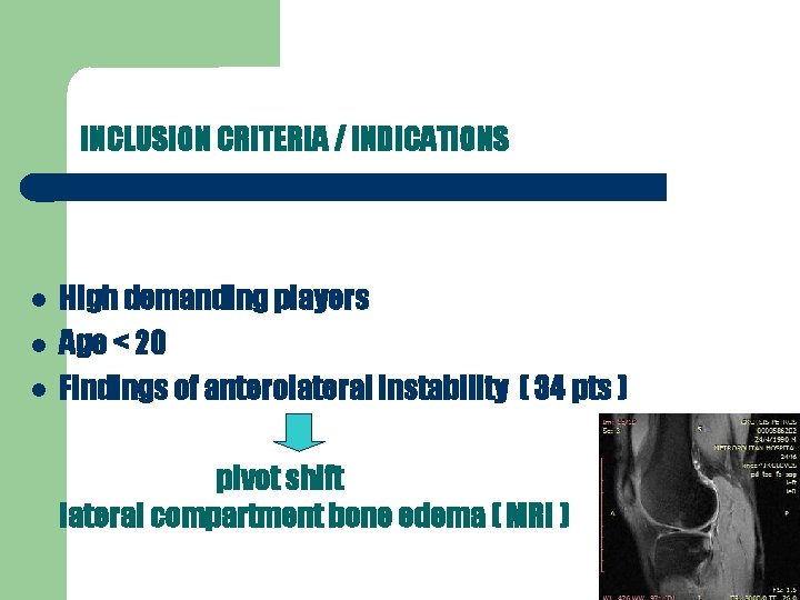 INCLUSION CRITERIA / INDICATIONS High demanding players Age < 20 Findings of anterolateral instability