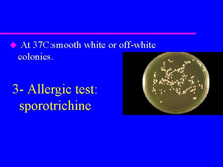 u At 37 C: smooth white or off-white colonies. 3 - Allergic test: sporotrichine