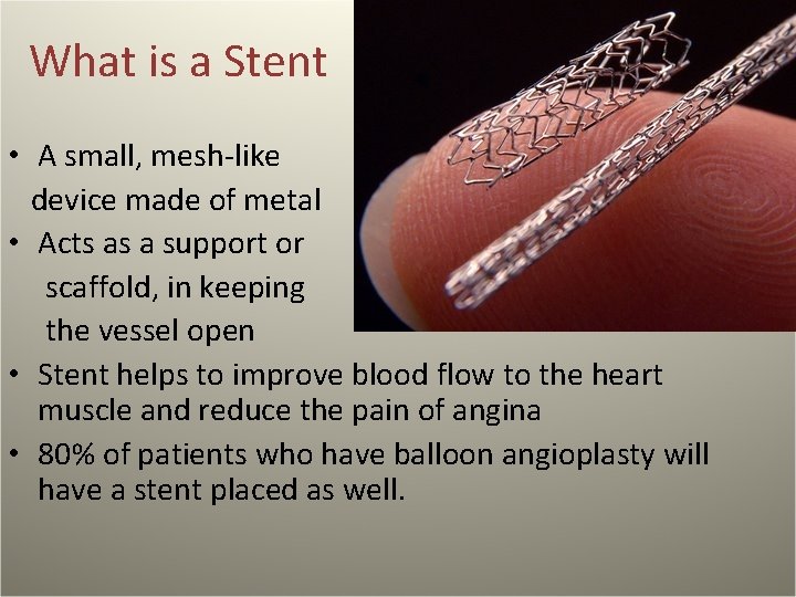 What is a Stent • A small, mesh-like device made of metal • Acts