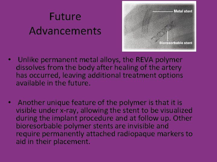 Future Advancements • Unlike permanent metal alloys, the REVA polymer dissolves from the body