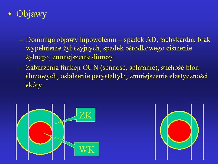  • Objawy – Dominują objawy hipowolemii – spadek AD, tachykardia, brak wypełnienie żył