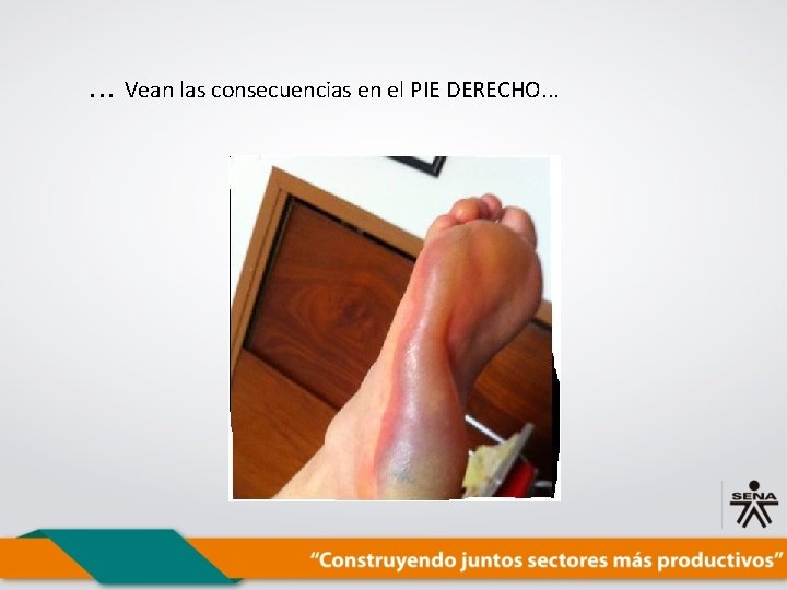 . . . Vean las consecuencias en el PIE DERECHO. . . 