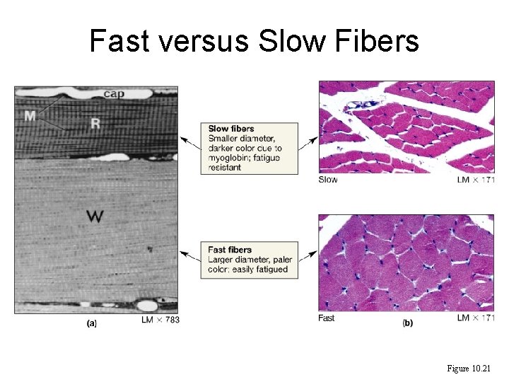 Fast versus Slow Fibers Figure 10. 21 