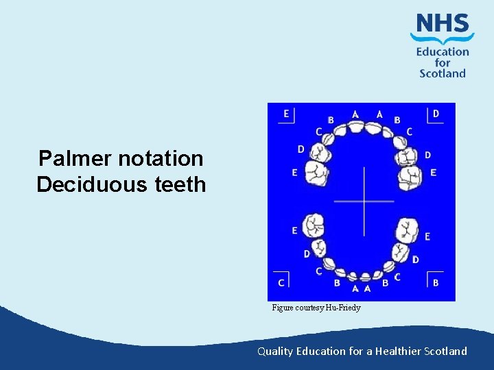 Palmer notation Deciduous teeth Figure courtesy Hu-Friedy Quality Education for a Healthier Scotland 