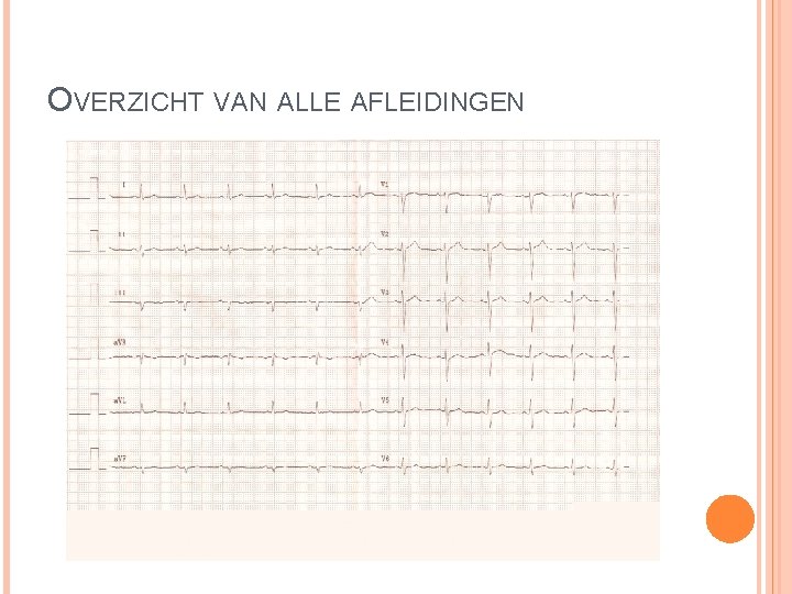 OVERZICHT VAN ALLE AFLEIDINGEN OVERZICHT VAN ALLE AFLEIDINGEN