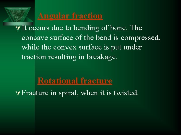 Angular fraction Ú It occurs due to bending of bone. The concave surface of