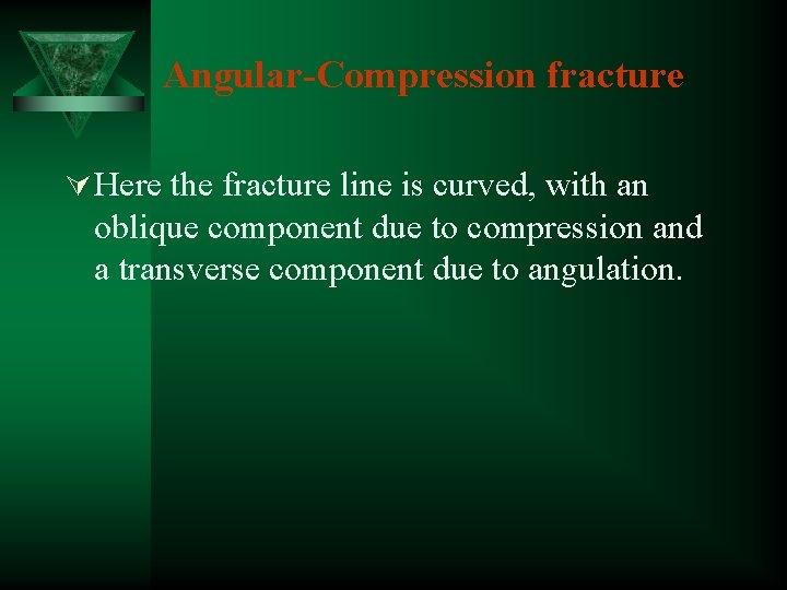 Angular-Compression fracture Ú Here the fracture line is curved, with an oblique component due