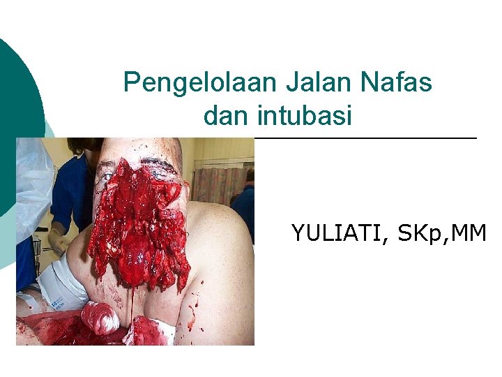 Pengelolaan Jalan Nafas dan intubasi YULIATI, SKp, MM 