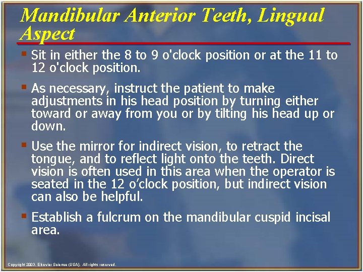 Mandibular Anterior Teeth, Lingual Aspect § Sit in either the 8 to 9 o'clock