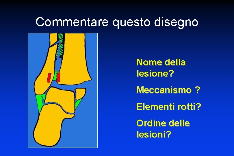 Commentare questo disegno Nome della lesione? Meccanismo ? Elementi rotti? Ordine delle lesioni? 