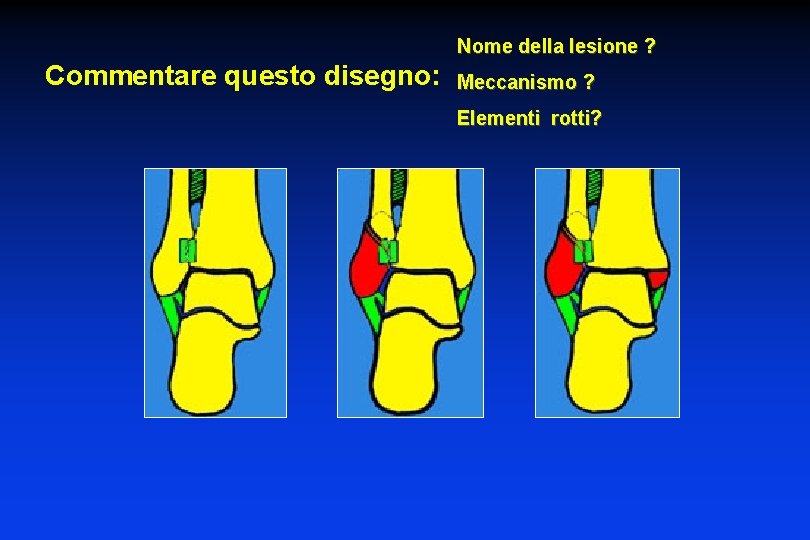 Nome della lesione ? Commentare questo disegno: Meccanismo ? Elementi rotti? 