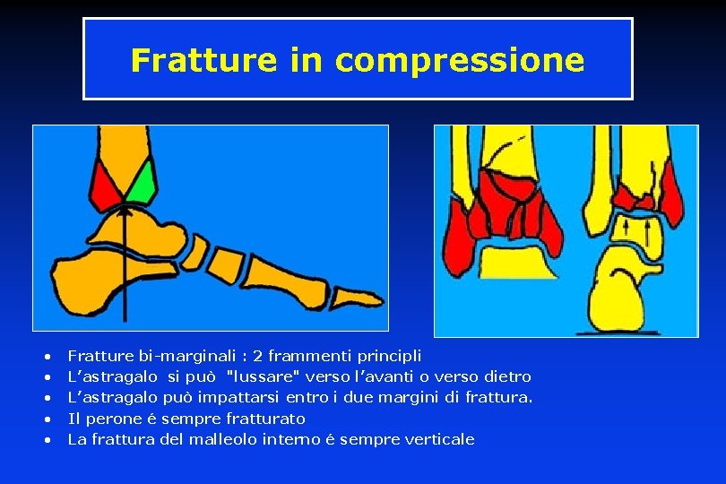 Fratture in compressione • • • Fratture bi-marginali : 2 frammenti principli L’astragalo si