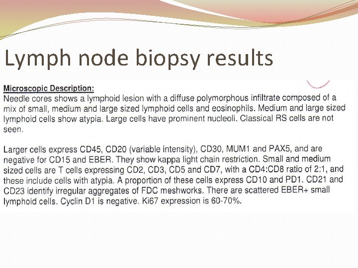 Lymph node biopsy results 