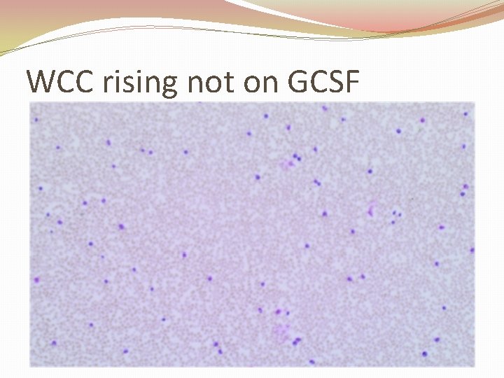 WCC rising not on GCSF 
