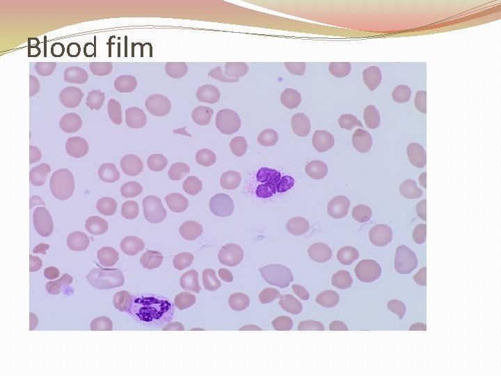 Blood film 