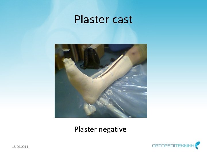Plaster cast Plaster negative 18. 09. 2014 