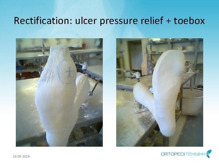 Rectification: ulcer pressure relief + toebox 18. 09. 2014 