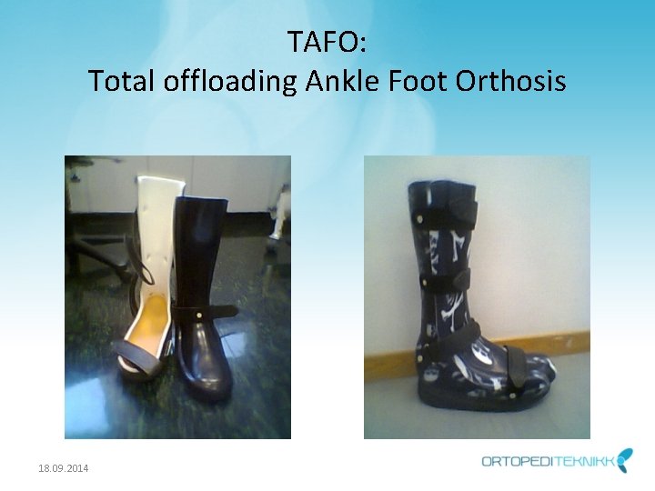 TAFO: Total offloading Ankle Foot Orthosis 18. 09. 2014 