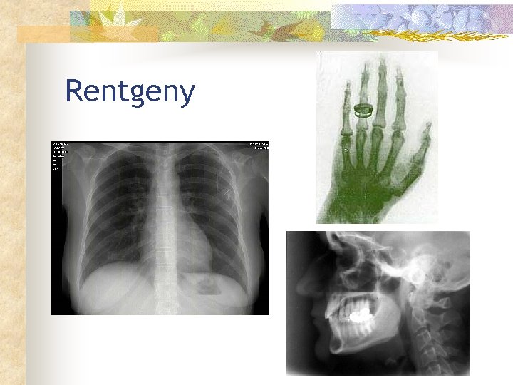 Rentgeny 