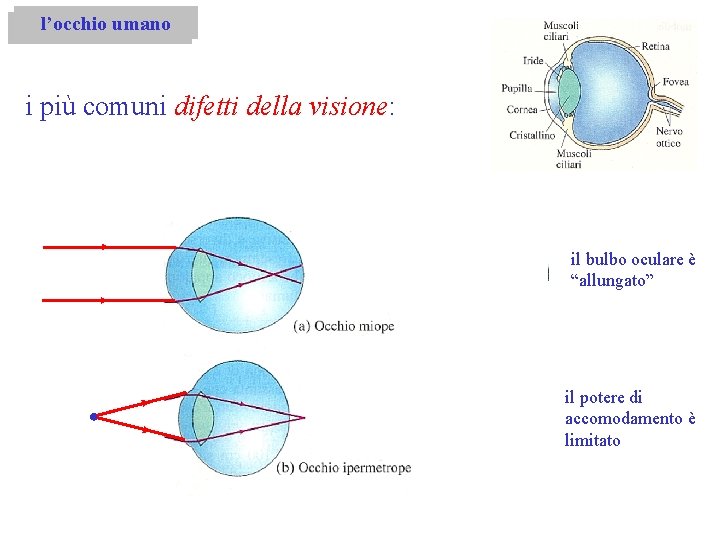 l’occhio umano i più comuni difetti della visione: il bulbo oculare è “allungato” il l’occhio umano i più comuni difetti della visione: il bulbo oculare è “allungato” il