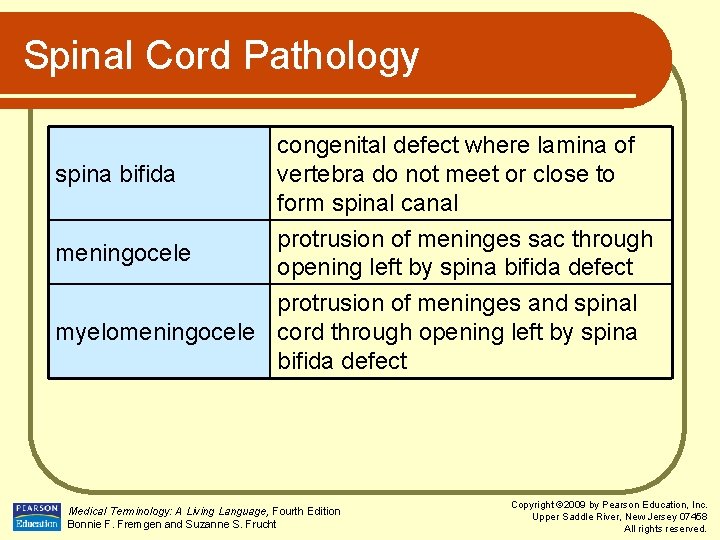 Spinal Cord Pathology spina bifida meningocele congenital defect where lamina of vertebra do not