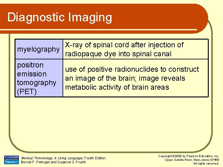 Diagnostic Imaging myelography X-ray of spinal cord after injection of radiopaque dye into spinal