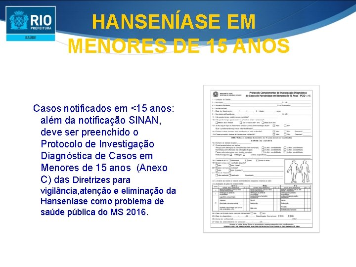 HANSENÍASE EM MENORES DE 15 ANOS Casos notificados em <15 anos: além da notificação