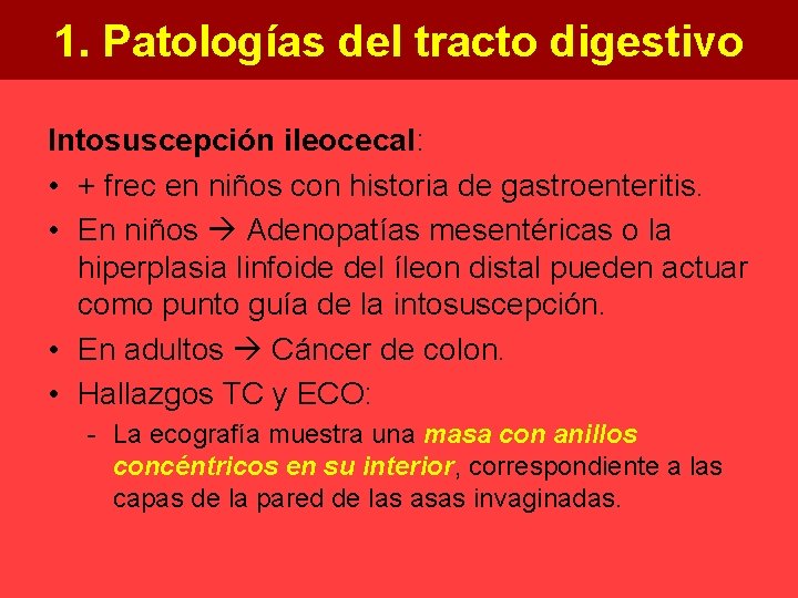 1. Patologías del tracto digestivo Intosuscepción ileocecal: • + frec en niños con historia