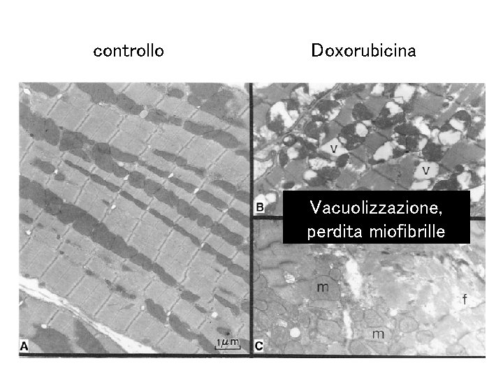 controllo Doxorubicina Vacuolizzazione, perdita miofibrille 