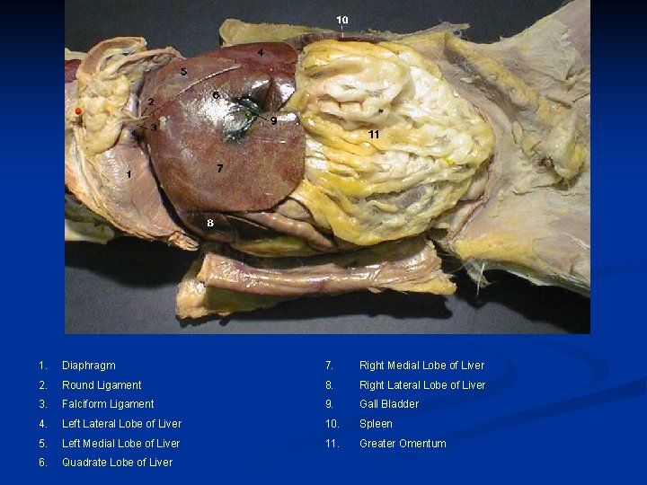 1. Diaphragm 7. Right Medial Lobe of Liver 2. Round Ligament 8. Right Lateral