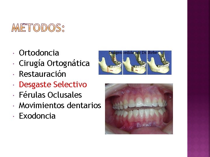  Ortodoncia Cirugía Ortognática Restauración Desgaste Selectivo Férulas Oclusales Movimientos dentarios Exodoncia 